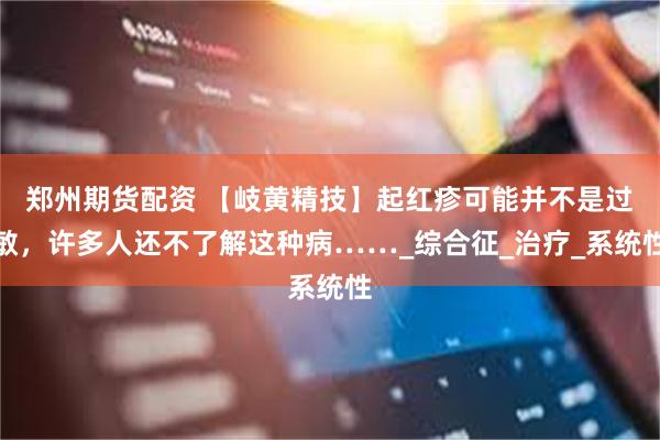 郑州期货配资 【岐黄精技】起红疹可能并不是过敏，许多人还不了解这种病……_综合征_治疗_系统性